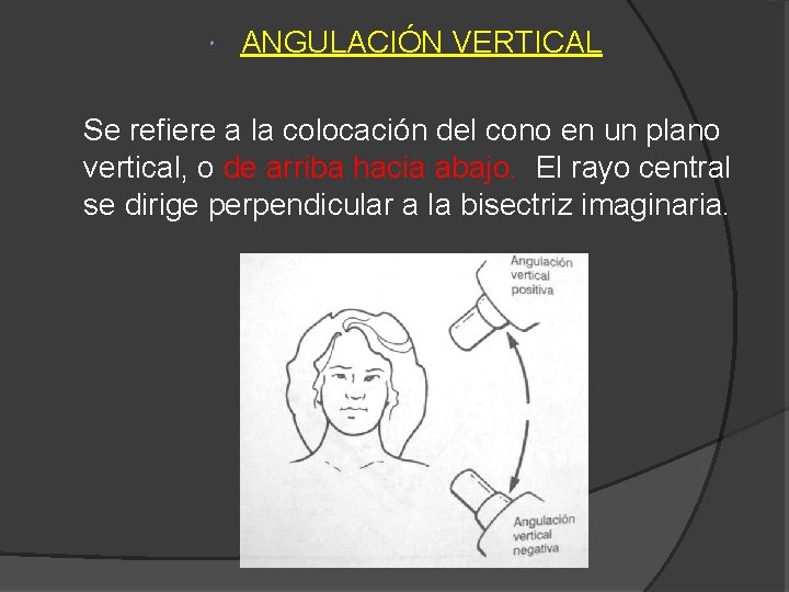  ANGULACIÓN VERTICAL Se refiere a la colocación del cono en un plano vertical,