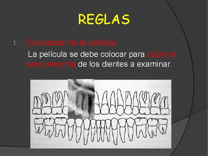 REGLAS 1. Colocación de la película: La película se debe colocar para cubrir el