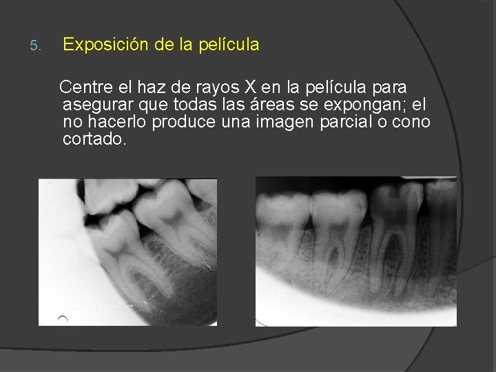5. Exposición de la película Centre el haz de rayos X en la película