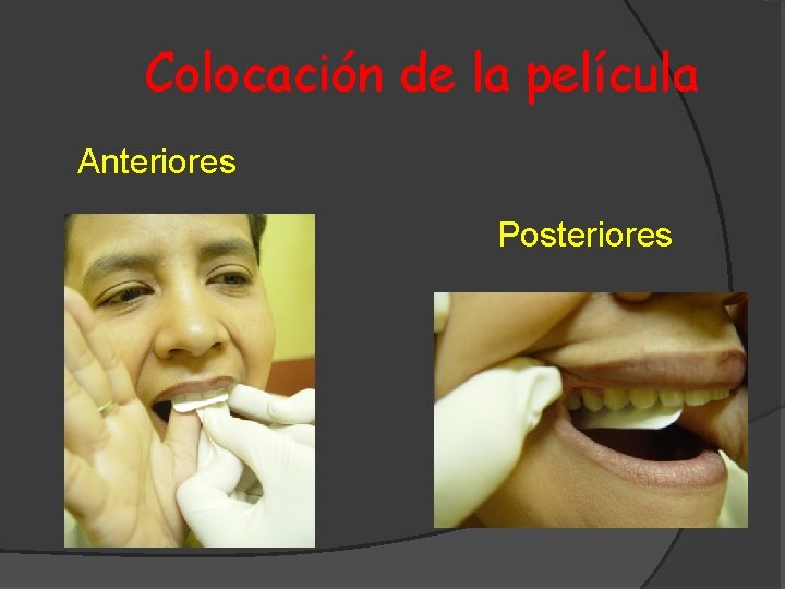 Colocación de la película Anteriores Posteriores 