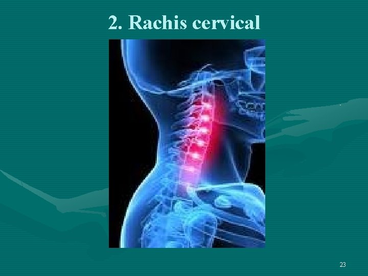 2. Rachis cervical 23 