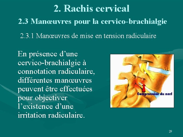 2. Rachis cervical 2. 3 Manœuvres pour la cervico-brachialgie 2. 3. 1 Manœuvres de