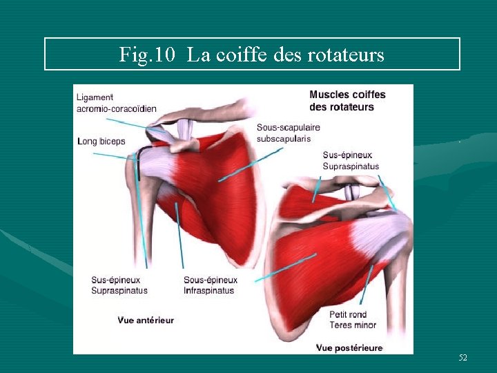 Fig. 10 La coiffe des rotateurs 52 