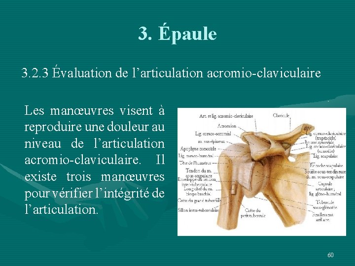 3. Épaule 3. 2. 3 Évaluation de l’articulation acromio-claviculaire Les manœuvres visent à reproduire