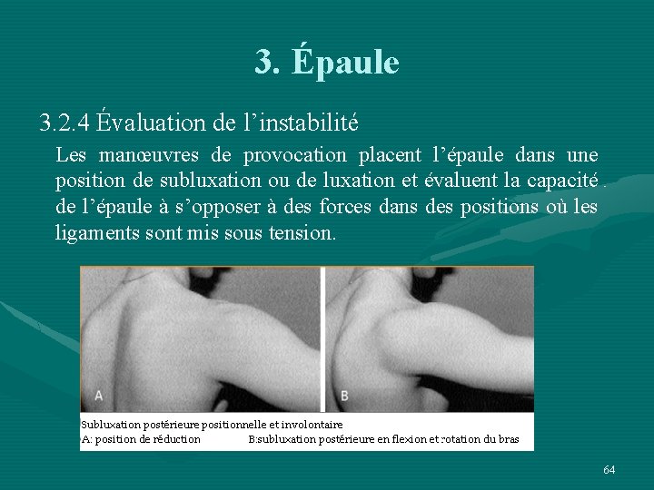 3. Épaule 3. 2. 4 Évaluation de l’instabilité Les manœuvres de provocation placent l’épaule