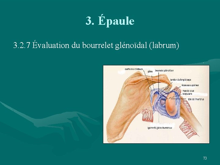 3. Épaule 3. 2. 7 Évaluation du bourrelet glénoïdal (labrum) 73 