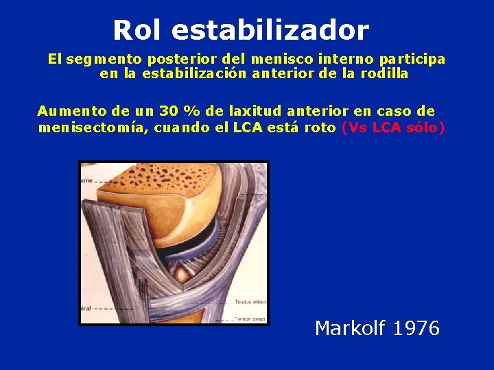 Rol estabilizador El segmento posterior del menisco interno participa en la estabilización anterior de