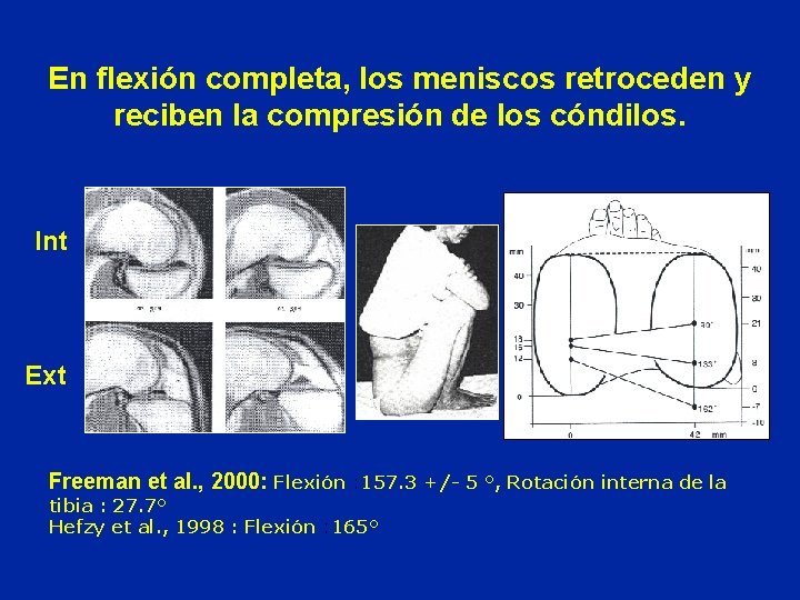 En flexión completa, los meniscos retroceden y reciben la compresión de los cóndilos. Int