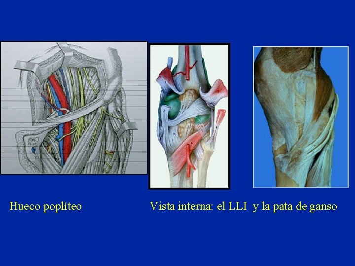 Hueco poplíteo Vista interna: el LLI y la pata de ganso 