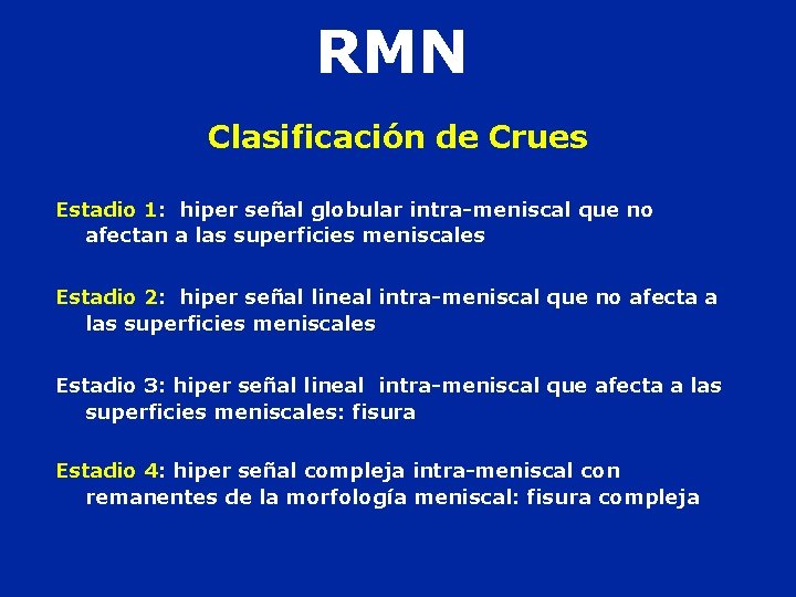 RMN Clasificación de Crues Estadio 1: hiper señal globular intra-meniscal que no afectan a