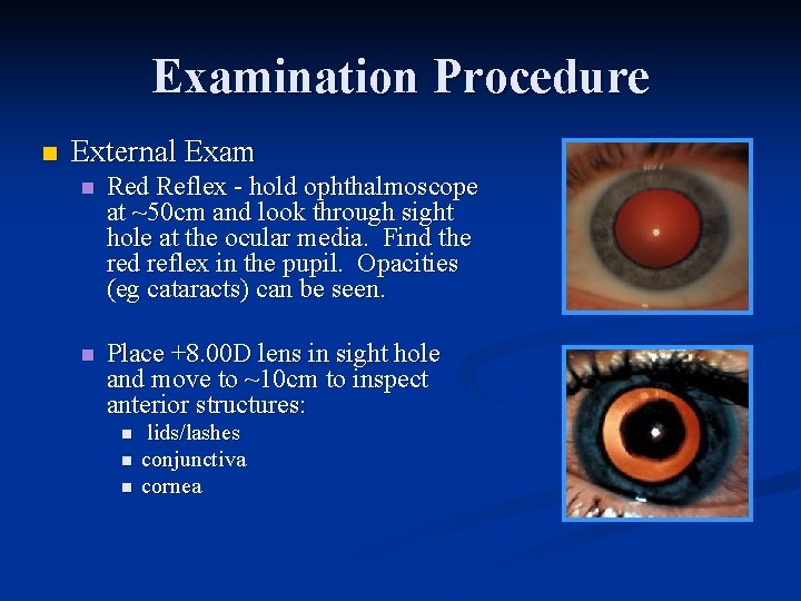 Examination Procedure n External Exam n Red Reflex - hold ophthalmoscope at ~50 cm