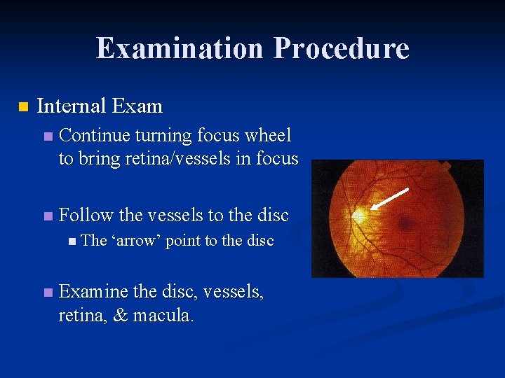 Examination Procedure n Internal Exam n Continue turning focus wheel to bring retina/vessels in