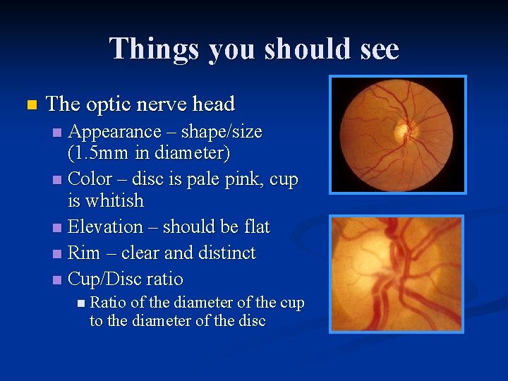 Things you should see n The optic nerve head Appearance – shape/size (1. 5