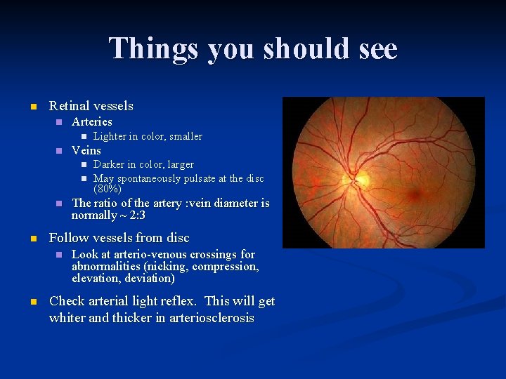Things you should see n Retinal vessels n Arteries n n Veins n n
