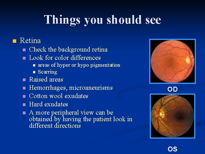 Things you should see n Retina n n Check the background retina Look for