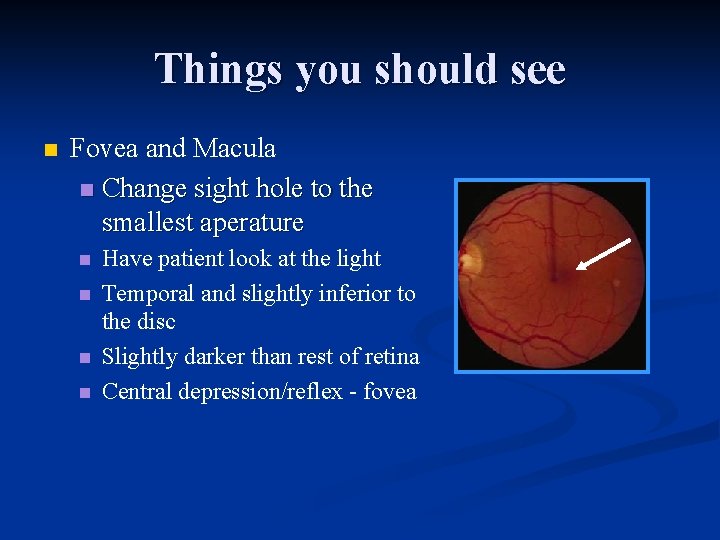 Things you should see n Fovea and Macula n Change sight hole to the