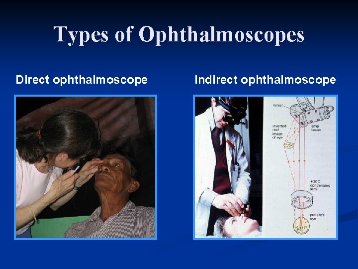 Types of Ophthalmoscopes Direct ophthalmoscope Indirect ophthalmoscope 