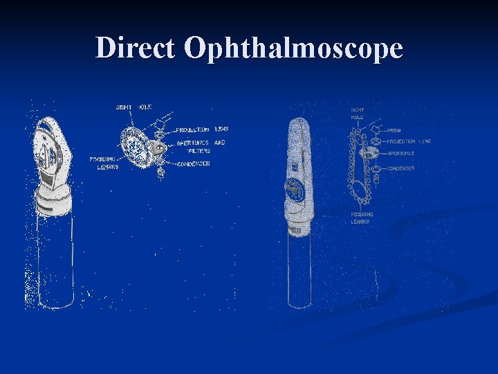 Direct Ophthalmoscope 