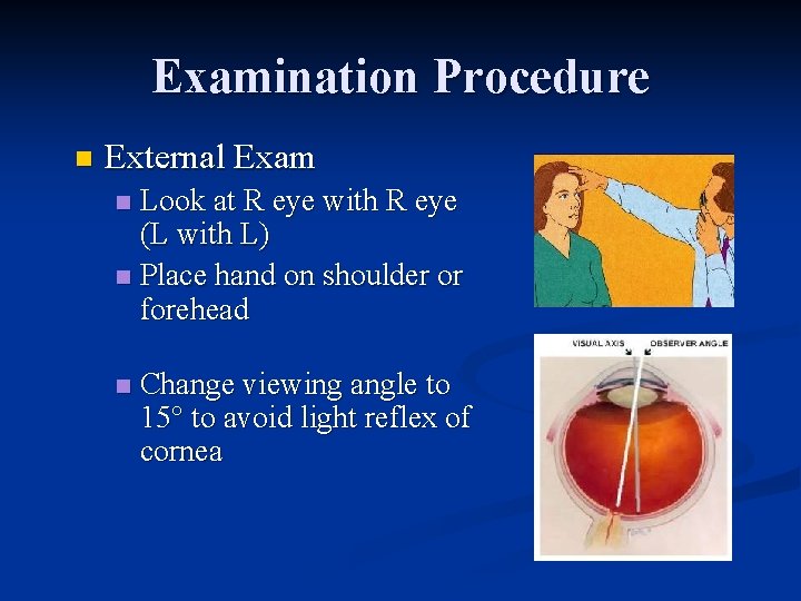 Examination Procedure n External Exam Look at R eye with R eye (L with