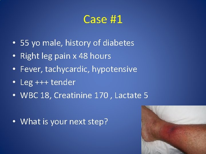 Case #1 • • • 55 yo male, history of diabetes Right leg pain