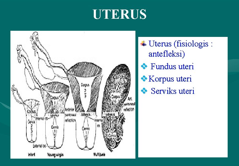 UTERUS Uterus (fisiologis : antefleksi) v Fundus uteri v Korpus uteri v Serviks uteri