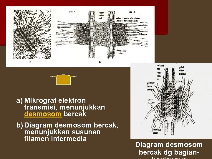 a) Mikrograf elektron transmisi, menunjukkan desmosom bercak b) Diagram desmosom bercak, menunjukkan susunan filamen