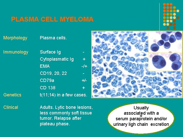 PLASMA CELL MYELOMA Morphology Plasma cells. Immunology Surface Ig - Cytoplasmatic Ig + EMA