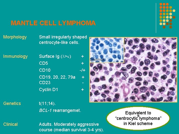 MANTLE CELL LYMPHOMA Morphology Small irregularly shaped centrocyte-like cells. Immunology Surface Ig (l>k) +