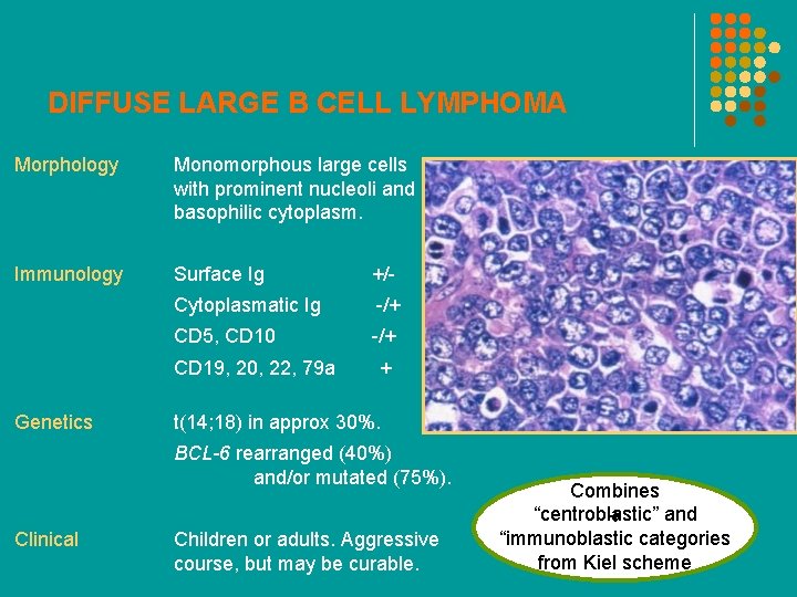DIFFUSE LARGE B CELL LYMPHOMA Morphology Monomorphous large cells with prominent nucleoli and basophilic