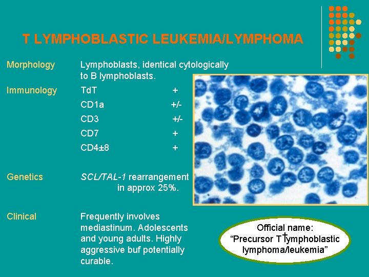 T LYMPHOBLASTIC LEUKEMIA/LYMPHOMA Morphology Lymphoblasts, identical cytologically to B lymphoblasts. Immunology Td. T +