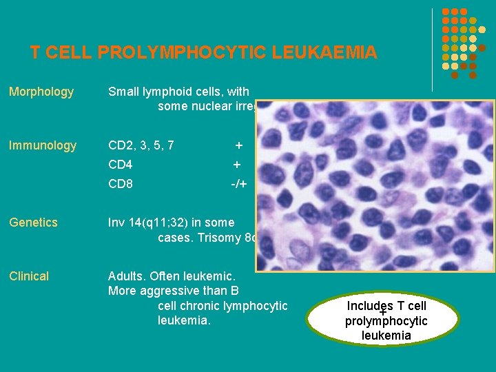 T CELL PROLYMPHOCYTIC LEUKAEMIA Morphology Small lymphoid cells, with some nuclear irregularity. Immunology CD