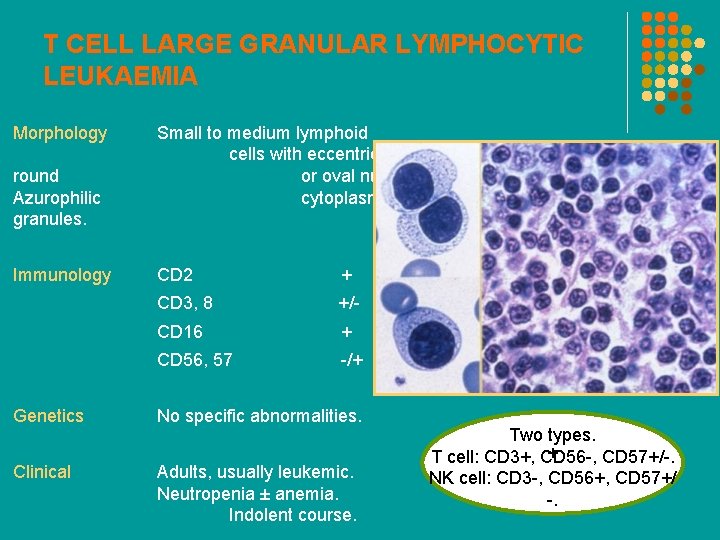 T CELL LARGE GRANULAR LYMPHOCYTIC LEUKAEMIA Morphology round Azurophilic granules. Immunology Small to medium