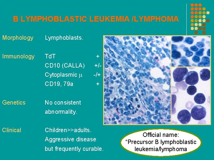 B LYMPHOBLASTIC LEUKEMIA /LYMPHOMA Morphology Lymphoblasts. Immunology Td. T + CD 10 (CALLA) +/-