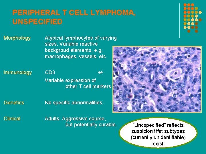 PERIPHERAL T CELL LYMPHOMA, UNSPECIFIED Morphology Atypical lymphocytes of varying sizes. Variable reactive backgroud