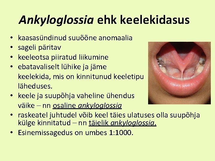 Ankyloglossia ehk keelekidasus kaasasündinud suuõõne anomaalia sageli päritav keeleotsa piiratud liikumine ebatavaliselt lühike ja