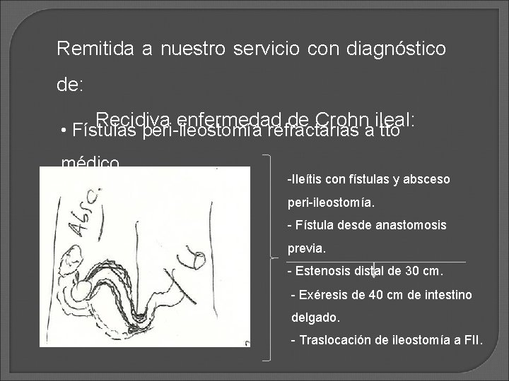 Remitida a nuestro servicio con diagnóstico de: Recidiva enfermedad de Crohn ileal: • Fístulas Remitida a nuestro servicio con diagnóstico de: Recidiva enfermedad de Crohn ileal: • Fístulas