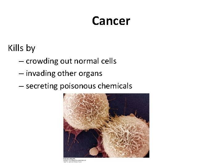 Cancer Kills by – crowding out normal cells – invading other organs – secreting