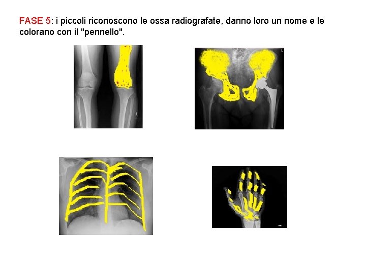 FASE 5: i piccoli riconoscono le ossa radiografate, danno loro un nome e le