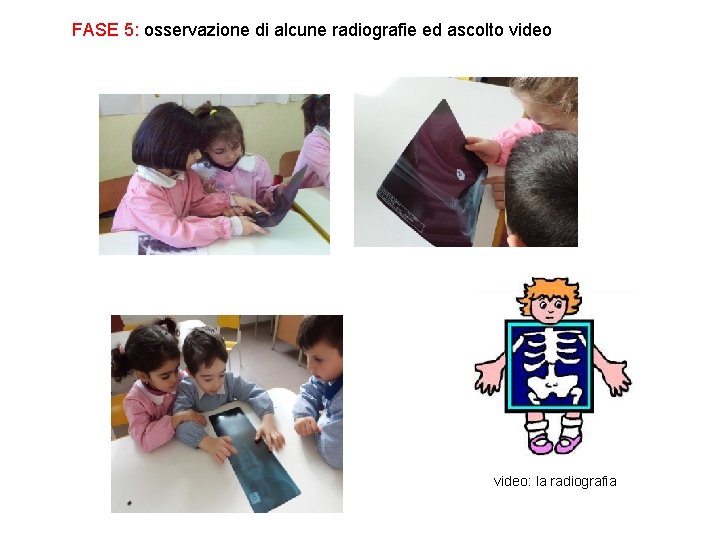 FASE 5: osservazione di alcune radiografie ed ascolto video: la radiografia 