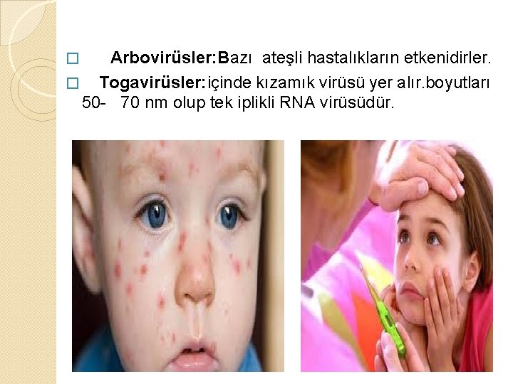 � Arbovirüsler: Bazı ateşli hastalıkların etkenidirler. � Togavirüsler: içinde kızamık virüsü yer alır. boyutları