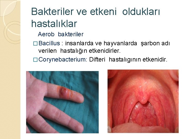 Bakteriler ve etkeni oldukları hastalıklar Aerob bakteriler � Bacillus : insanlarda ve hayvanlarda şarbon