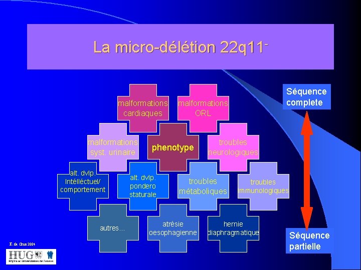 La micro-délétion 22 q 11 - malformations cardiaques malformations syst. urinaire alt. dvlp. Intélléctuel/