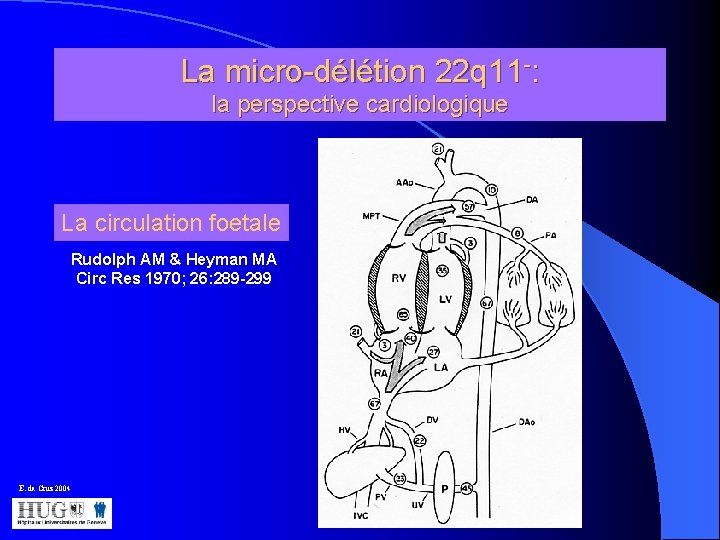 La micro-délétion 22 q 11 -: la perspective cardiologique La circulation foetale Rudolph AM