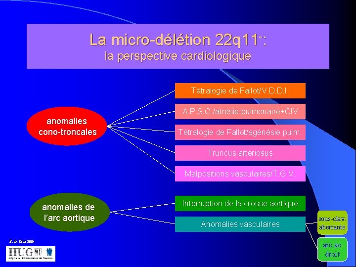La micro-délétion 22 q 11 -: la perspective cardiologique Tétralogie de Fallot/V. D. D.