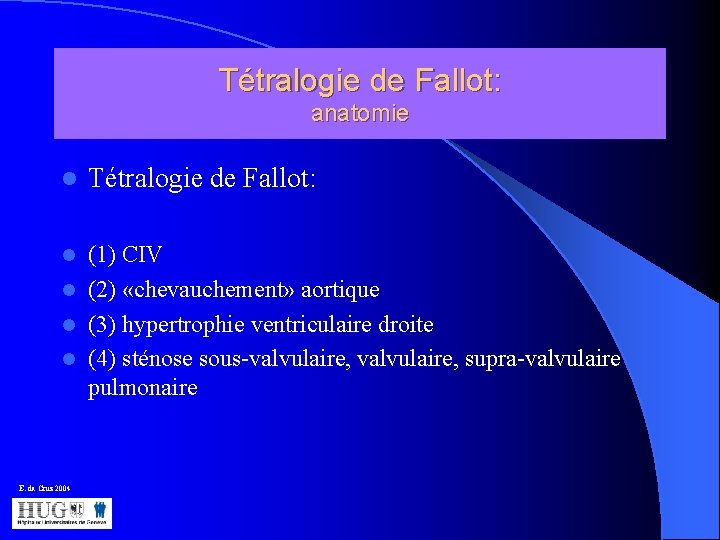 Tétralogie de Fallot: anatomie l Tétralogie de Fallot: (1) CIV l (2) «chevauchement» aortique