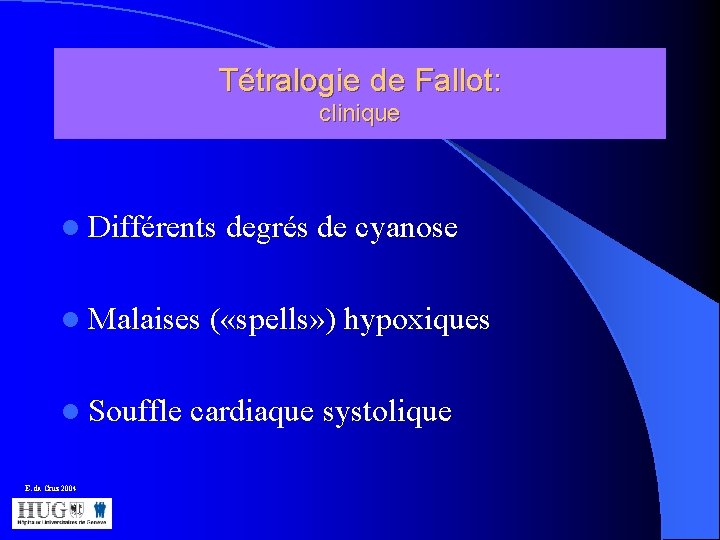 Tétralogie de Fallot: clinique l Différents degrés de cyanose l Malaises ( «spells» )