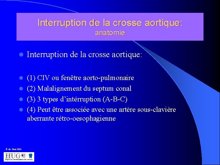 Interruption de la crosse aortique: anatomie l Interruption de la crosse aortique: (1) CIV