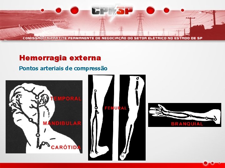 Hemorragia externa Pontos arteriais de compressão 