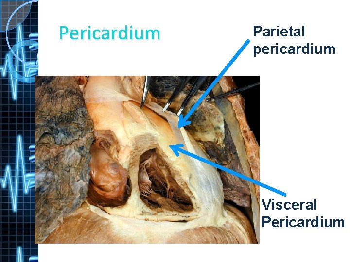 Pericardium Parietal pericardium Visceral Pericardium 