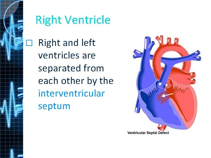 Right Ventricle � Right and left ventricles are separated from each other by the